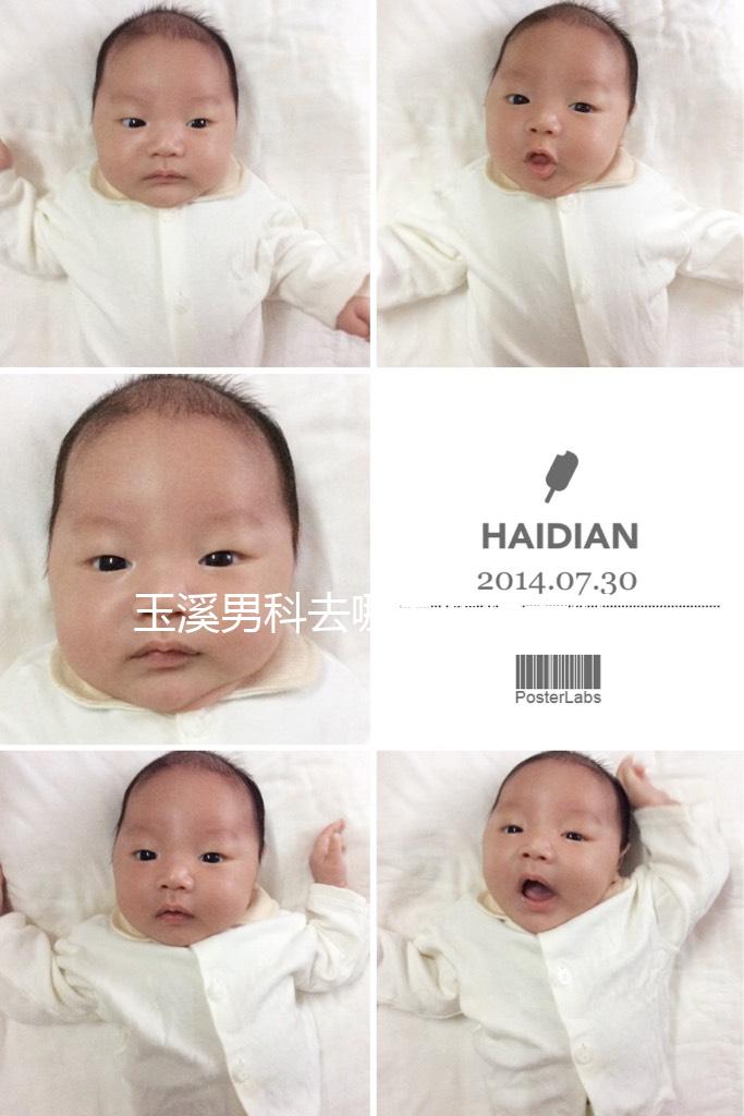 玉溪男科去哪家醫院看好，怎么選攻略，這個排行榜不要錯過