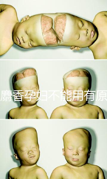 白麝香孕婦不能用有原因，流產(chǎn)、早產(chǎn)…這些危害不得不知