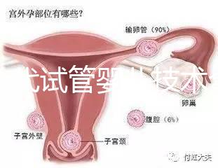 第一代試管嬰兒技術(shù)全解析:流程、適應(yīng)癥及優(yōu)缺點指南