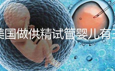 美國做供精試管嬰兒有三大條件，想知道需不需要結婚證戳