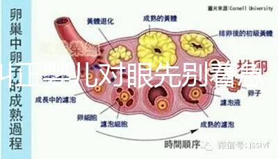 糾正嬰兒對眼先別著急,眼科醫(yī)生教你3招鑒別法