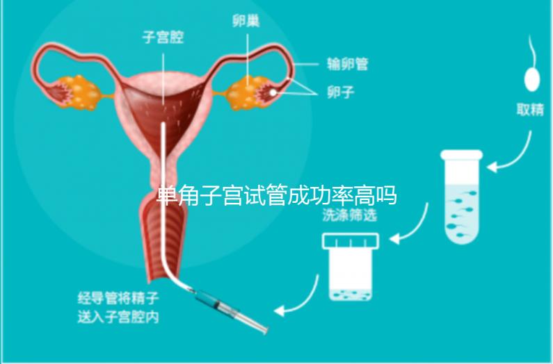 單角子宮試管成功率高嗎？送你5招降低胚胎著床的難度