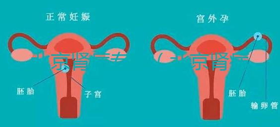 北京腎病專家(北京腎病專家前十名)