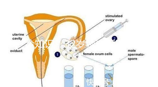冷知識！32歲做試管嬰兒提升成功率的方法請收藏