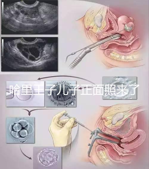 哈里王子兒子正面照來了，梅根評價：氣質(zhì)甜美，乖巧