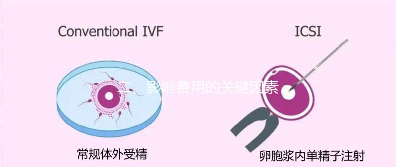 二、影響費(fèi)用的關(guān)鍵因素