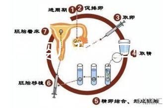 代試管嬰兒和第二代試管嬰兒的區(qū)別，基因篩查技術(shù)！