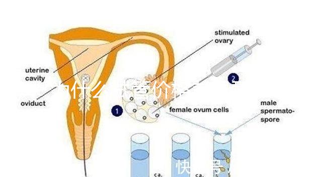 為什么試管價格差異那么大?做試管到底要花多少錢?