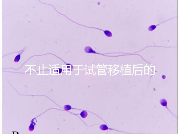 不止適用于試管移植后的胚胎著床,美卓樂(lè)的8大作用盤(pán)點(diǎn)