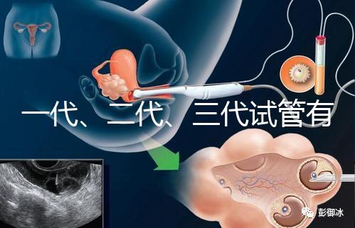 一代、二代、三代試管有什么區(qū)別？
