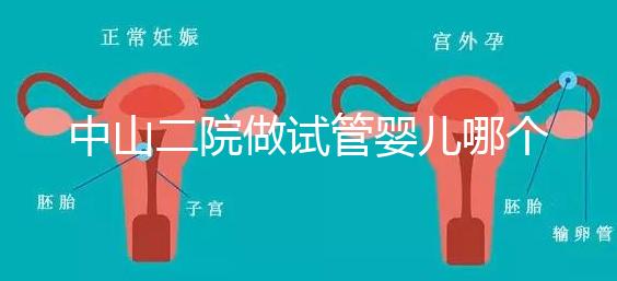 中山二院做試管嬰兒哪個醫生好？附醫院試管成功率