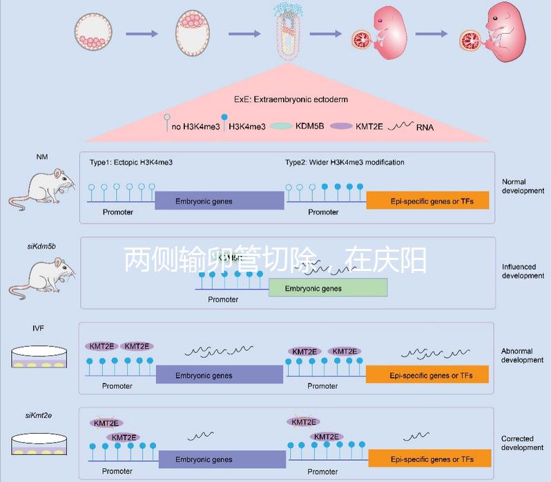 兩側輸卵管切除，在慶陽有醫院能做試管嬰兒嗎？