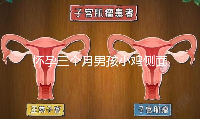 懷孕三個(gè)月男孩小雞側(cè)面二維b超圖片分享,原來(lái)兩腿間有尖