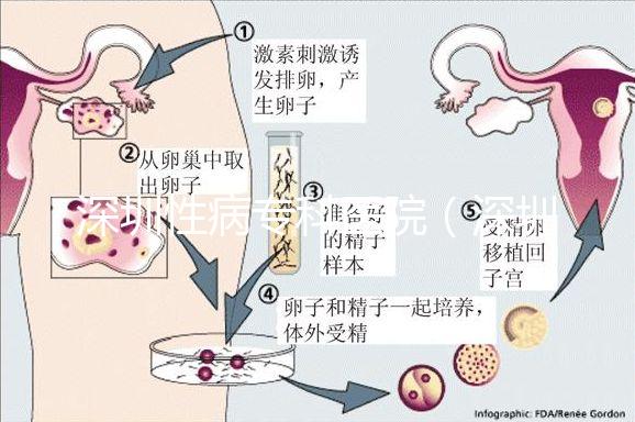深圳性病專科醫院(深圳hpv病毒治療中心)