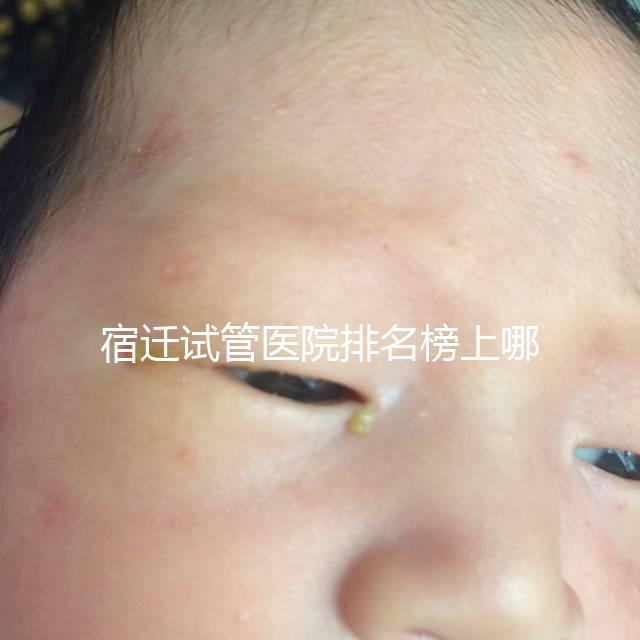 宿遷試管醫院排名榜上哪家好，不造助孕成功率和費用別亂選