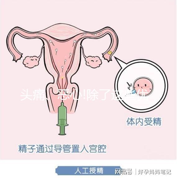 頭痛、惡心!除了這些優思明副作用還有哪些