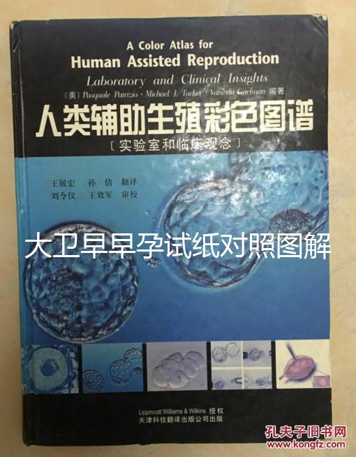 大衛(wèi)早早孕試紙對照圖解,教你怎么看結(jié)果是不是陽性