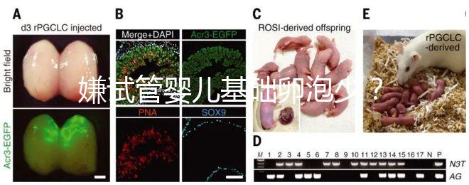 嫌試管嬰兒基礎卵泡少？并非只能食療，這份增多錦囊請收下