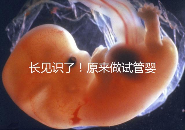 長見識(shí)了!原來做試管嬰兒,精子是這樣被篩選出來的