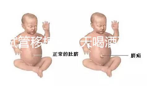 試管移植前幾天喝酒了有影響嗎？想要懷孕得管住嘴！