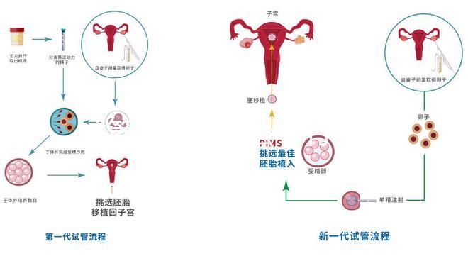 試管嬰兒是老公不行嗎(試管嬰兒是老公不行嗎還是女孩)