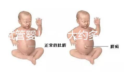 試管嬰兒費(fèi)用大約多少2021年:國(guó)內(nèi)試管之(10)額外可能需要費(fèi)用: