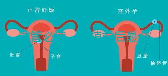 試管必讀，移植前后最全注意事項？