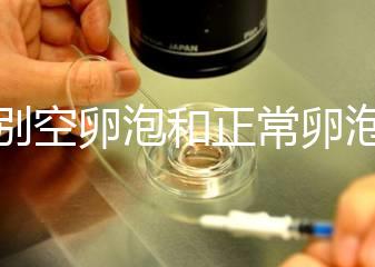 辨別空卵泡和正常卵泡是有技巧的，只需要了解這四個方面就可以輕松辨別，快速學(xué)習(xí)！
