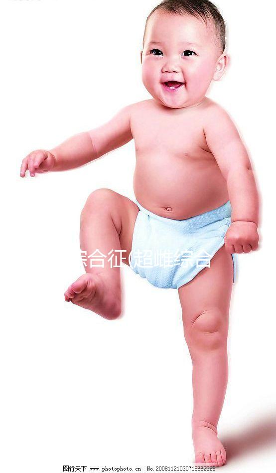 XXX綜合征(超雌綜合征)是什么？一種性染色體異常的疾病