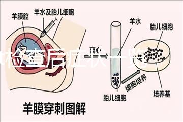 tct檢查后癥狀一覽，專家提醒做好處理措施是關鍵